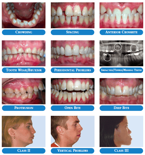 Common Problems - Adult Orthodontics