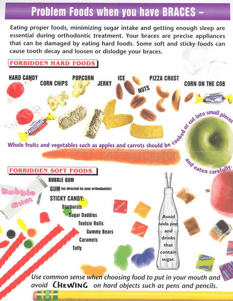 Problem foods when you have braces