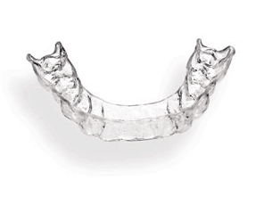 orthodontic retention phase