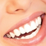 Teeth Whitening and Teens