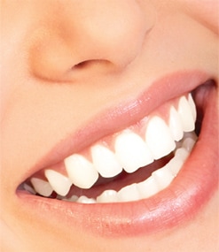 Teeth Whitening and Teens