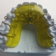 dental-braces-542262_640