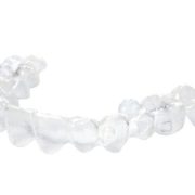 invisalign aligner