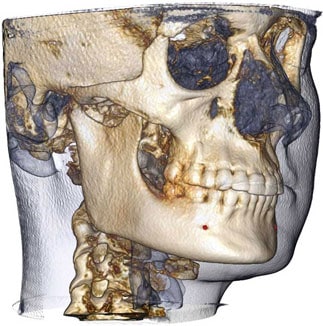 Advanced 3D Imaging of a person.