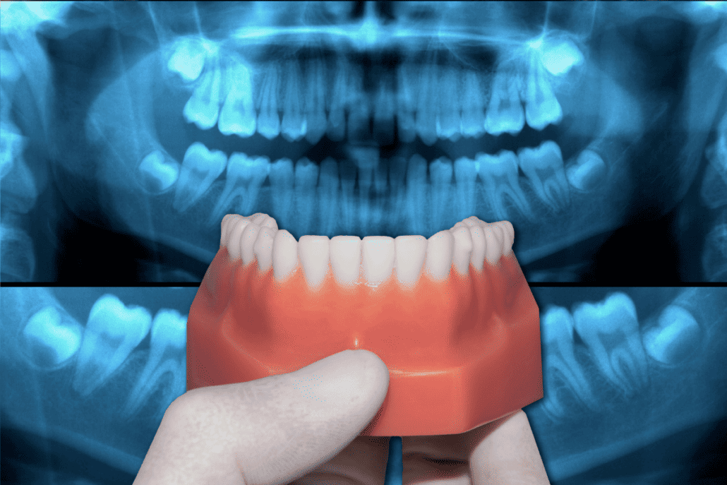 orthodontic x rays 
