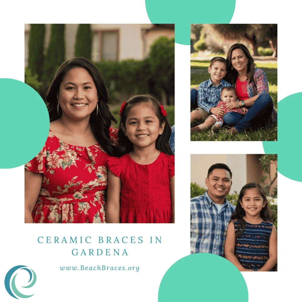 Ceramic Braces in Gardena, CA - Beach Braces