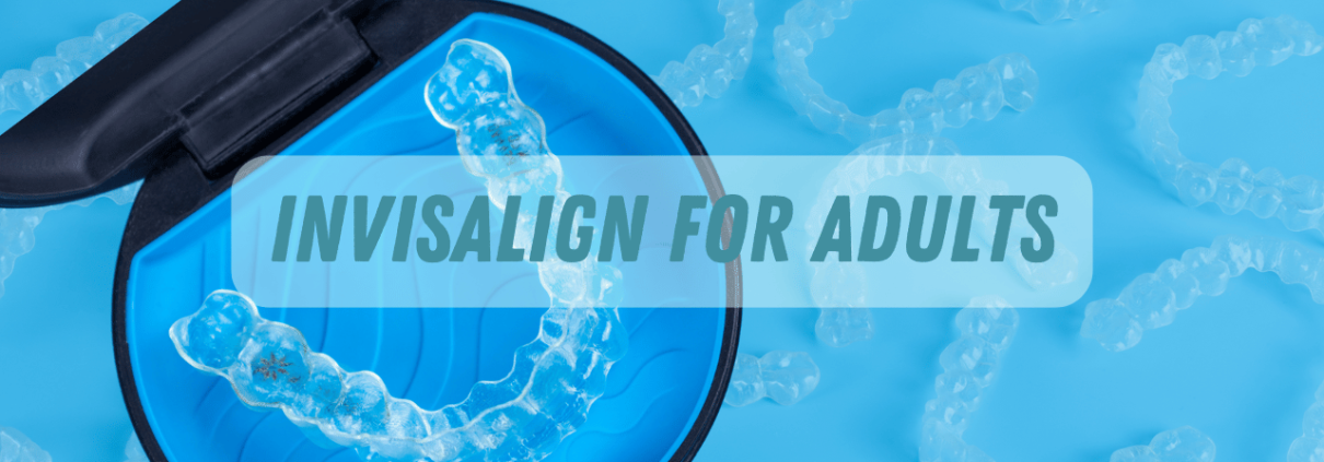 Invisalign for Adults - Beach Braces