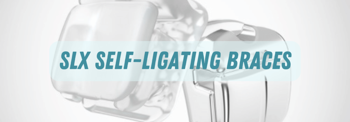 SLX Self-ligating Braces - Manhattan Beach