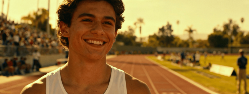 Invisalign Lite - Beach Braces Orthodontics