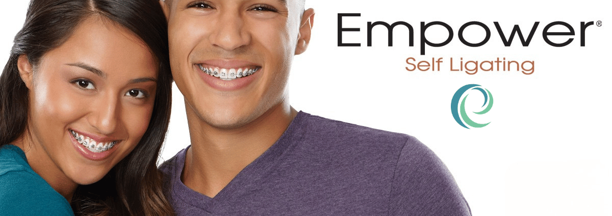 Empower Self-ligating braces at Beach Braces