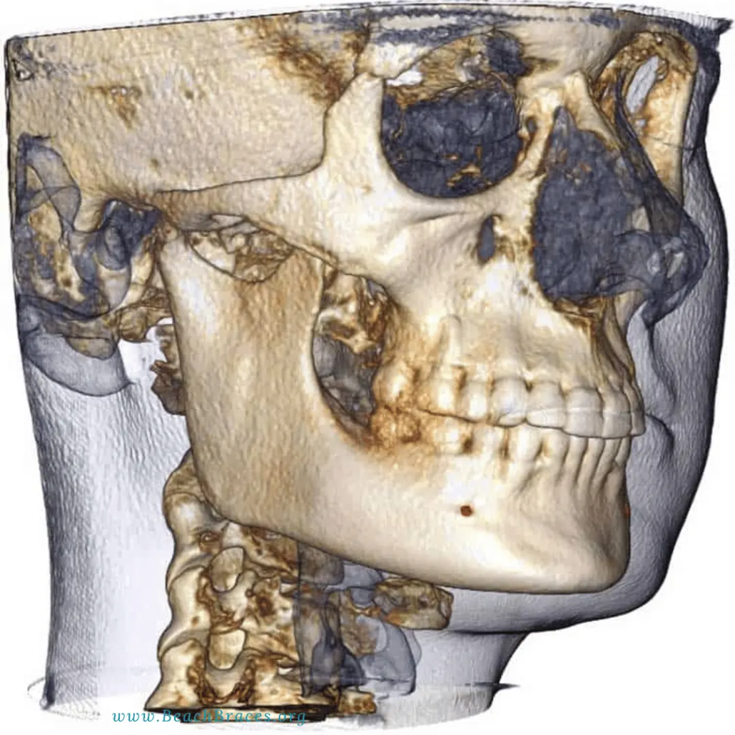 Advanced 3D imaging at Beach Braces